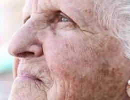 老人斑是什么原因引起？由以下原因造成
